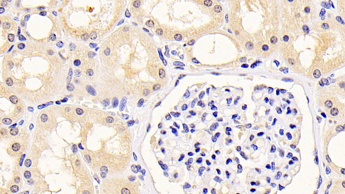 Monoclonal Antibody to Kidney Injury Molecule 1 (Kim1)