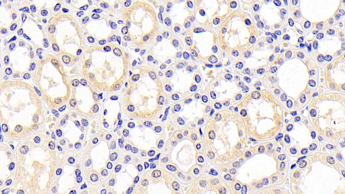 Monoclonal Antibody to Kidney Injury Molecule 1 (Kim1)