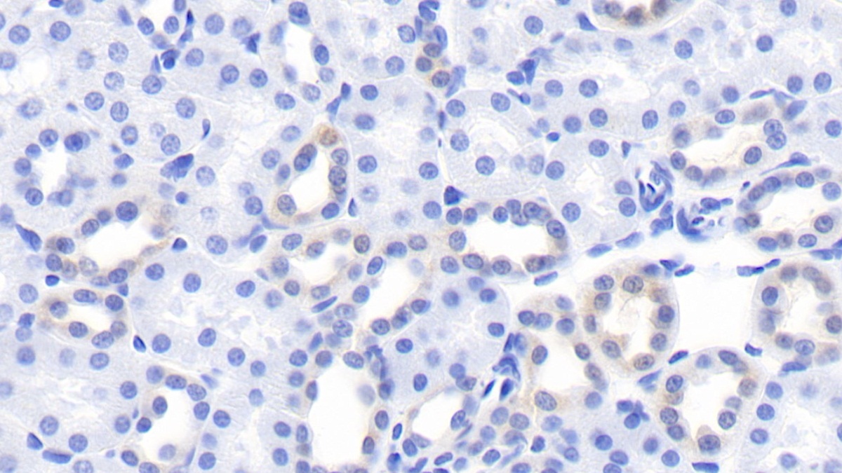 Monoclonal Antibody to Kidney Injury Molecule 1 (Kim1)