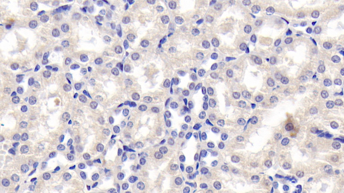 Monoclonal Antibody to Angiotensinogen (AGT)