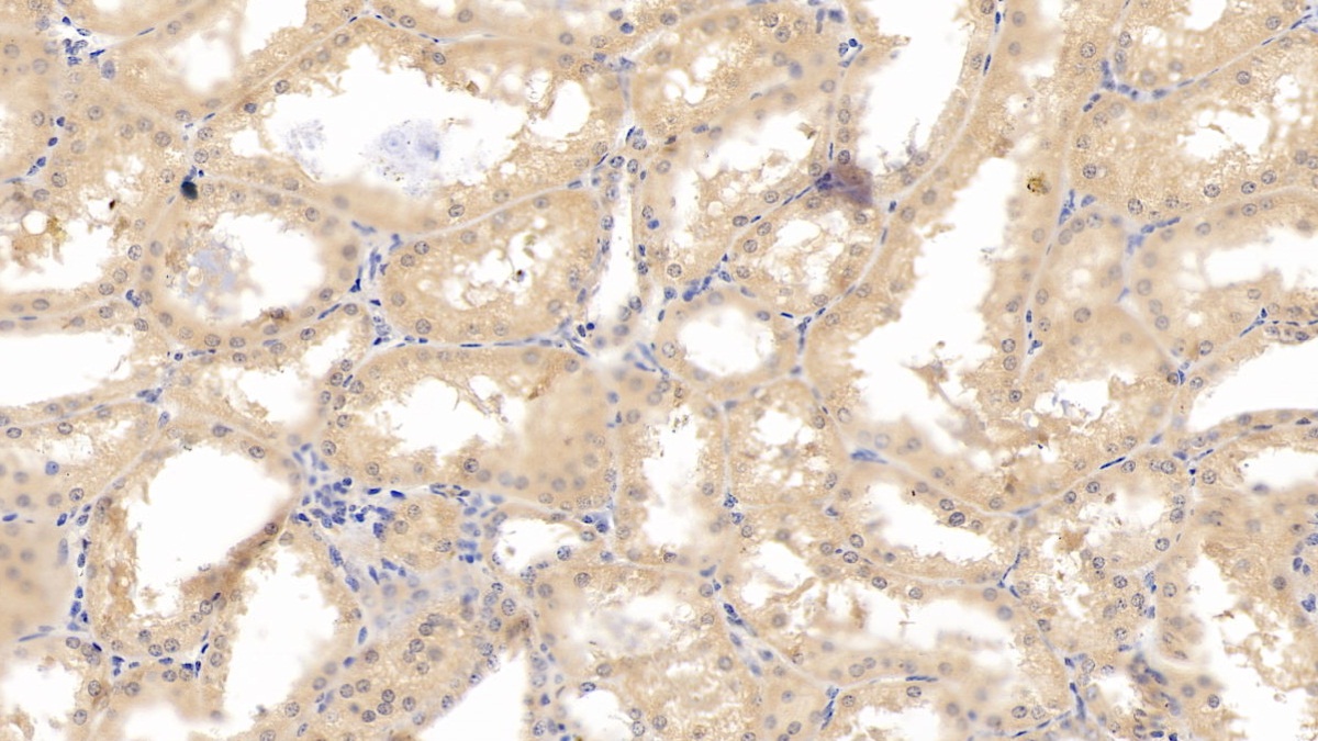 Monoclonal Antibody to Hypoxia Inducible Factor 1 Alpha (HIF1a)