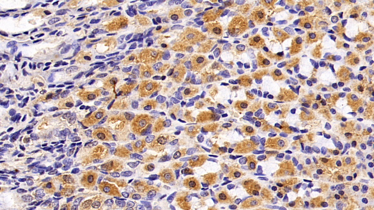 Monoclonal Antibody to Cholecystokinin (CCK)