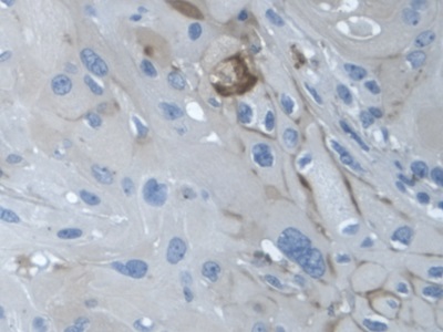 Monoclonal Antibody to Alpha-1-Acid Glycoprotein (a1AGP)