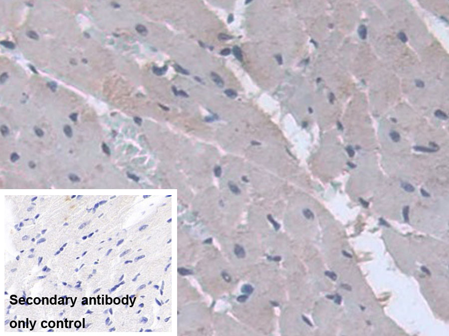 Monoclonal Antibody to Alpha-1-Acid Glycoprotein (a1AGP)