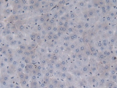 Monoclonal Antibody to Coagulation Factor II (F2)