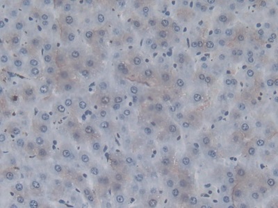 Monoclonal Antibody to Coagulation Factor II (F2)