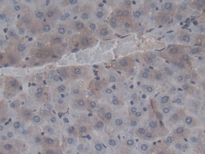 Monoclonal Antibody to Coagulation Factor II (F2)