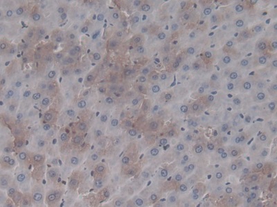 Monoclonal Antibody to Coagulation Factor II (F2)