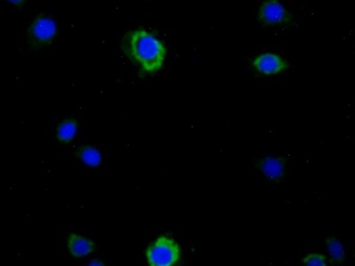 Monoclonal Antibody to Heat Shock Protein 60 (Hsp60)