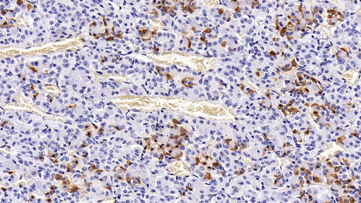 Monoclonal Antibody to Prolactin (PRL)