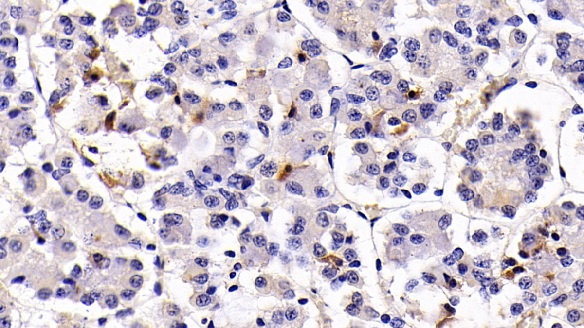 Monoclonal Antibody to Prolactin (PRL)