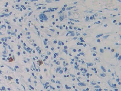 Monoclonal Antibody to Resistin (RETN)