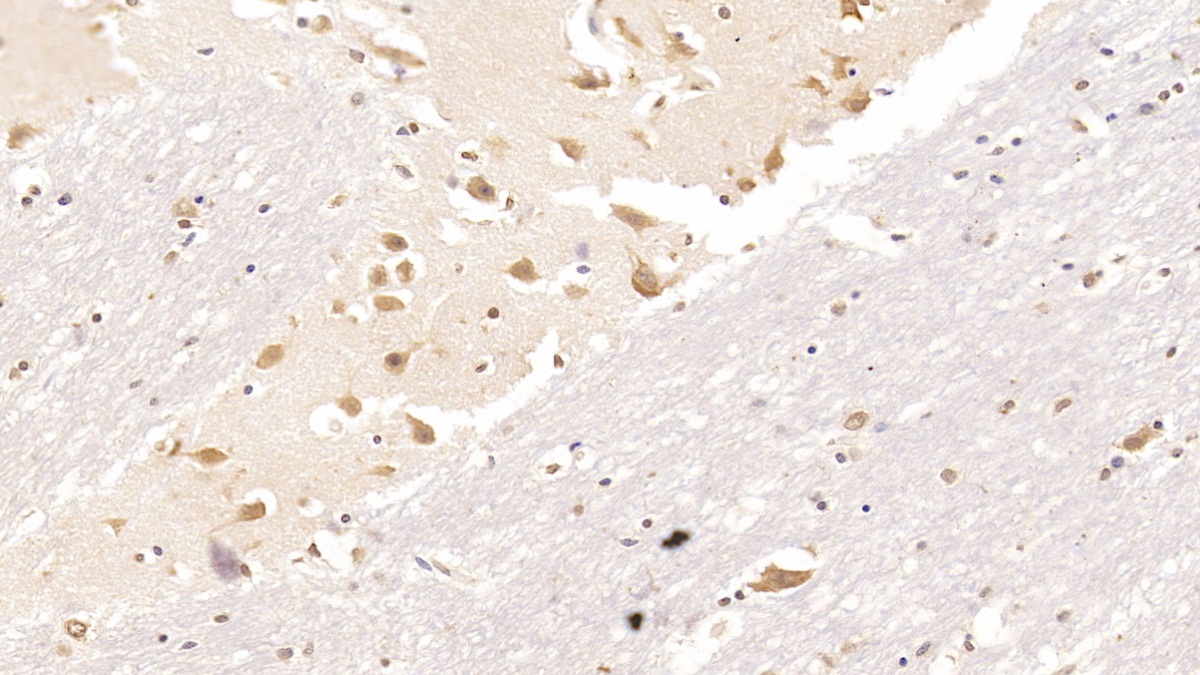 Monoclonal Antibody to Resistin (RETN)