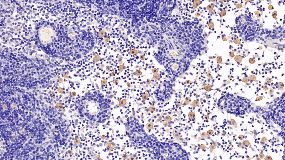 Monoclonal Antibody to Caspase 8 (CASP8)