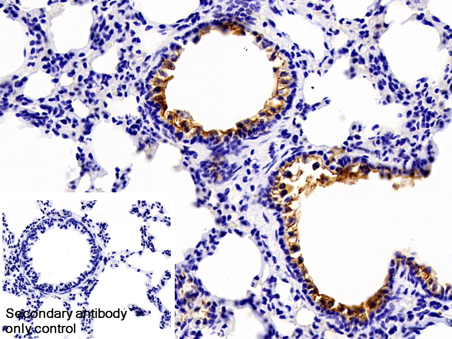 Monoclonal Antibody to Clara Cell Protein 16 (CC16)