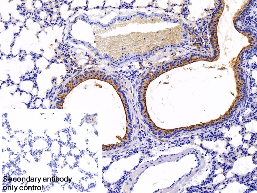 Monoclonal Antibody to Clara Cell Protein 16 (CC16)