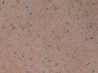 Monoclonal Antibody to Gastric Inhibitory Polypeptide (GIP)