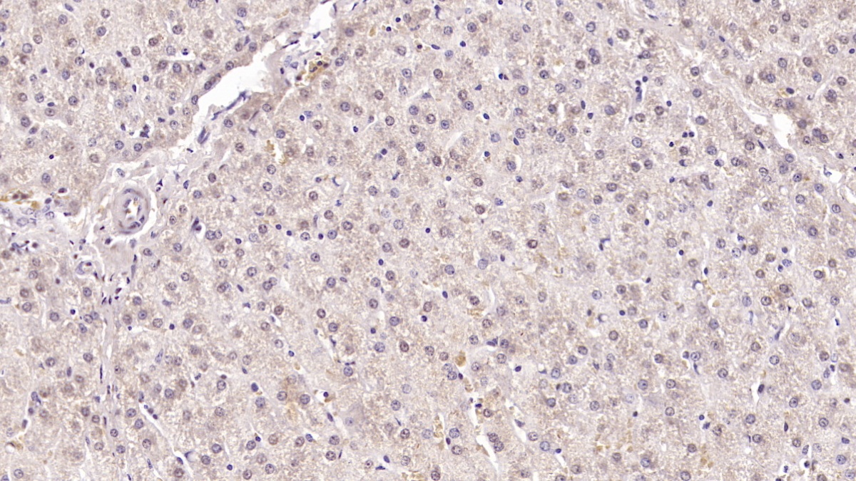 Monoclonal Antibody to Serum Amyloid A (SAA)