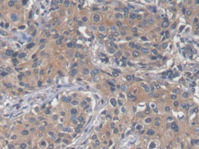 Monoclonal Antibody to Serum Amyloid A (SAA)