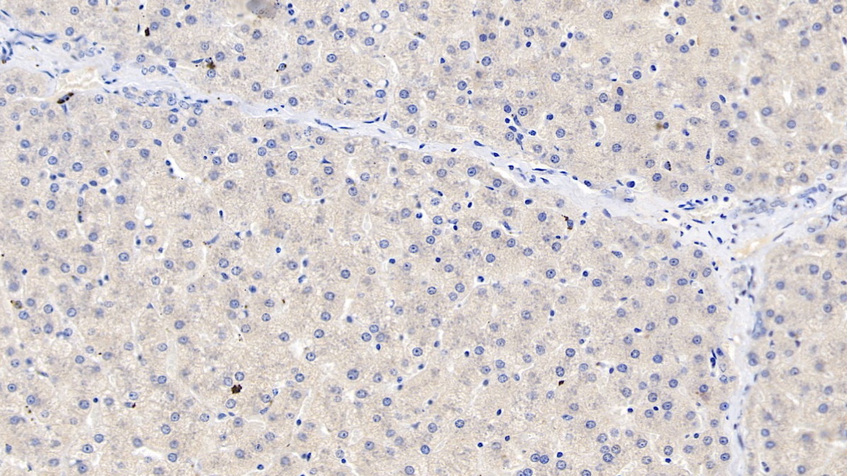 Monoclonal Antibody to Serum Amyloid A (SAA)