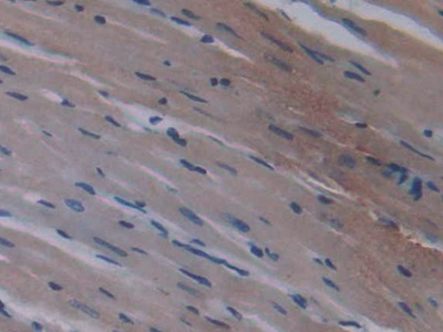 Monoclonal Antibody to Peroxisome Proliferator Activated Receptor Gamma (PPARg)