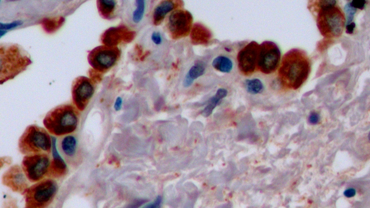 Monoclonal Antibody to Pulmonary Surfactant Associated Protein A1 (SFTPA1)