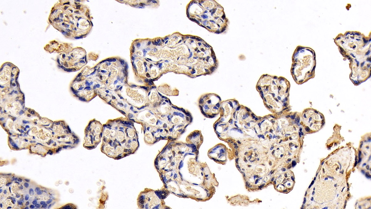 Monoclonal Antibody to Insulin Receptor (INSR)