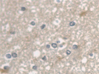 Monoclonal Antibody to Cystatin C (Cys-C)