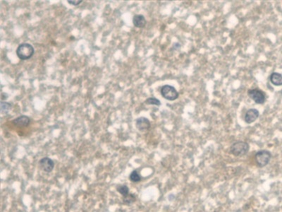 Monoclonal Antibody to Cystatin C (Cys-C)