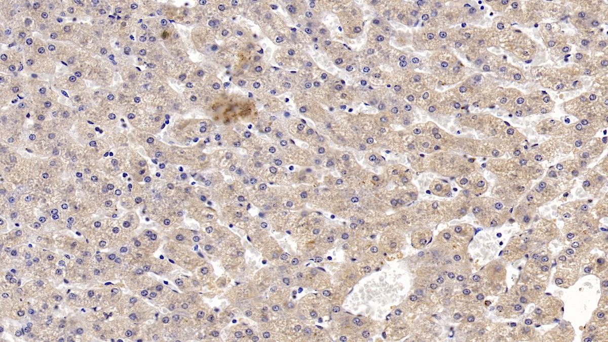 Monoclonal Antibody to Ceruloplasmin (CP)