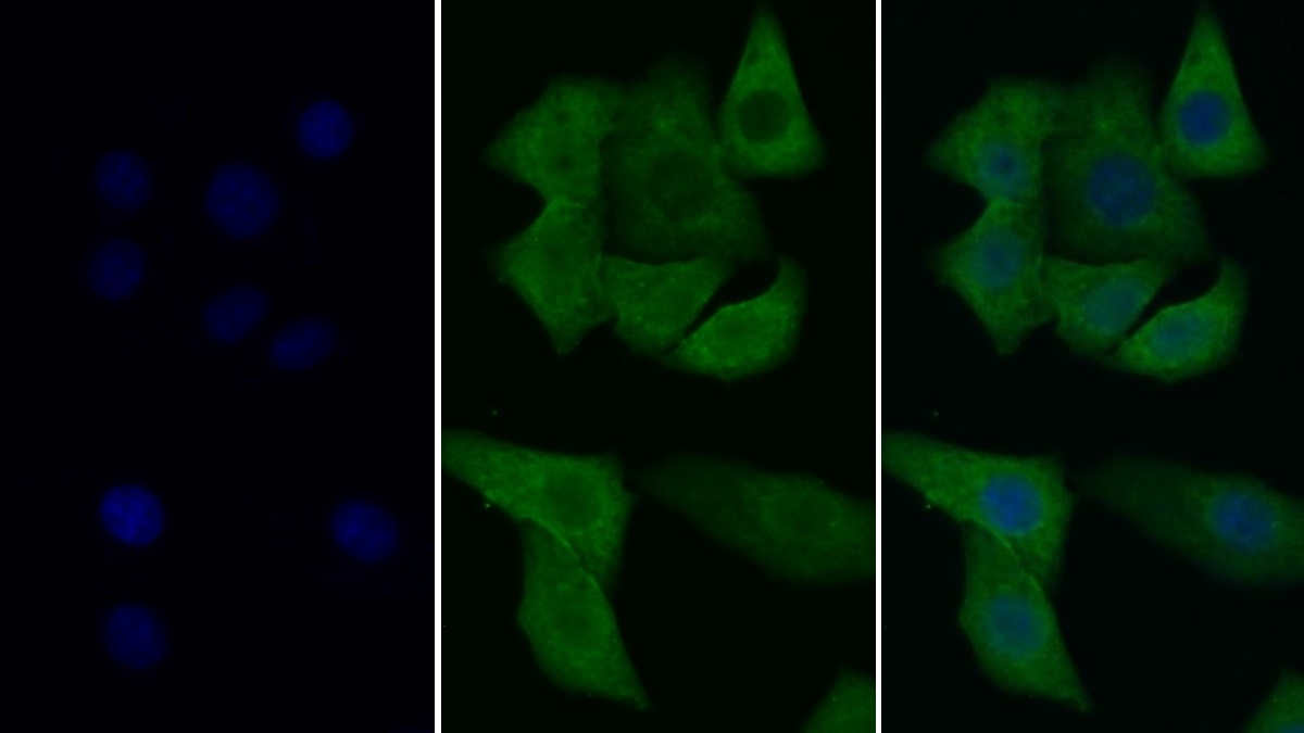 Monoclonal Antibody to Extracellular Signal Regulated Kinase 2 (ERK2)