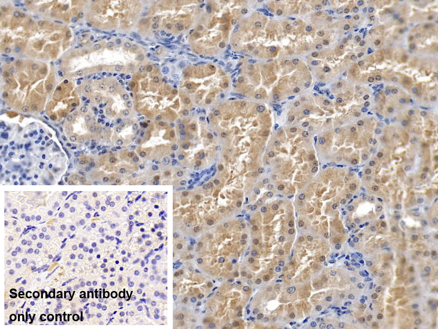 Monoclonal Antibody to Nephrin (NPHN)