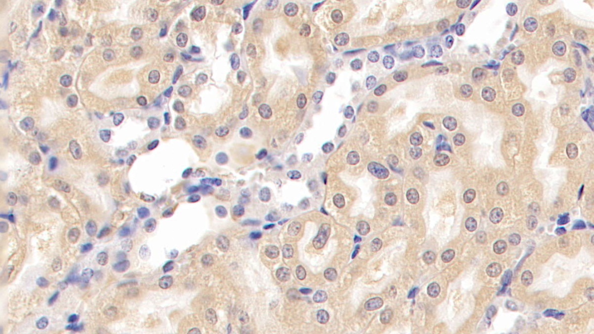 Monoclonal Antibody to Nephrin (NPHN)