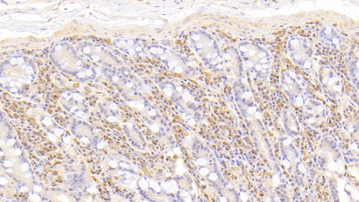 Monoclonal Antibody to Neutrophil Specific Antigen 1 (NB1)