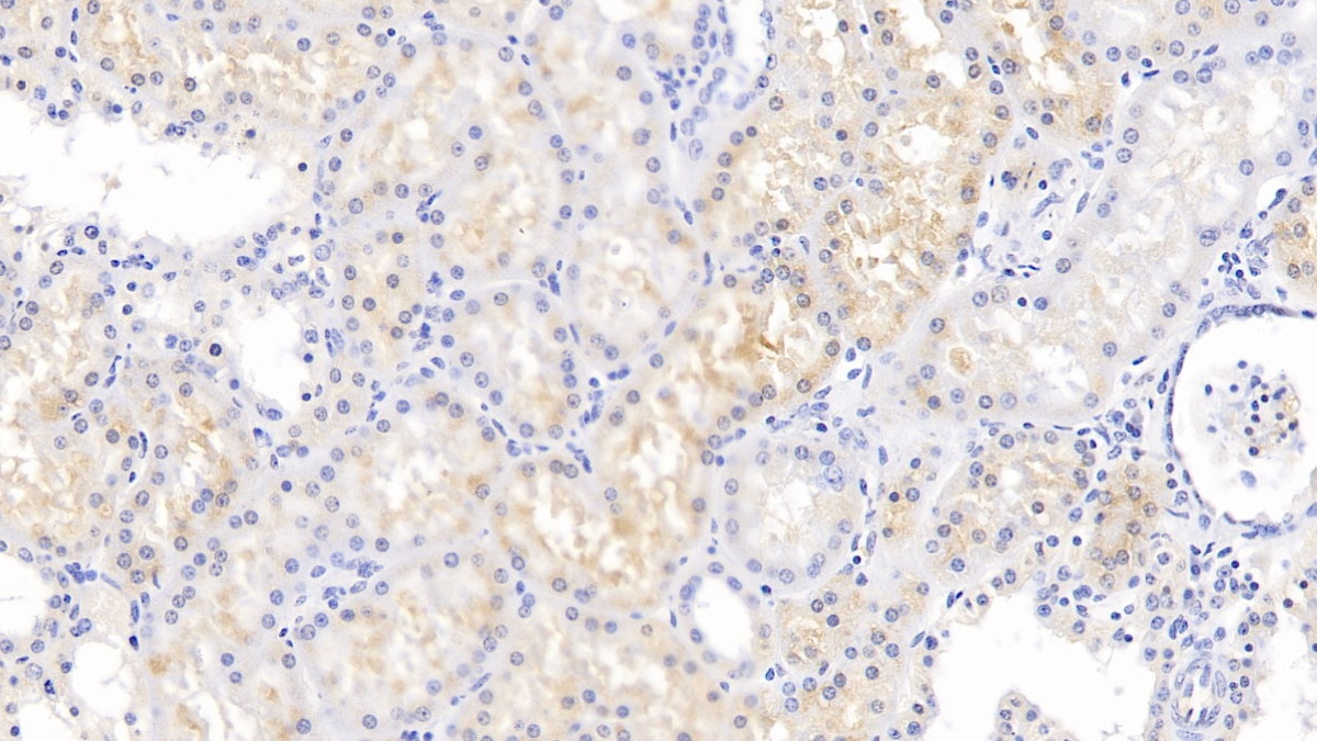 Monoclonal Antibody to Chemerin (CHEM)