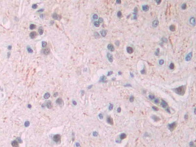 Monoclonal Antibody to Amyloid Beta Peptide 1-42 (Ab1-42)