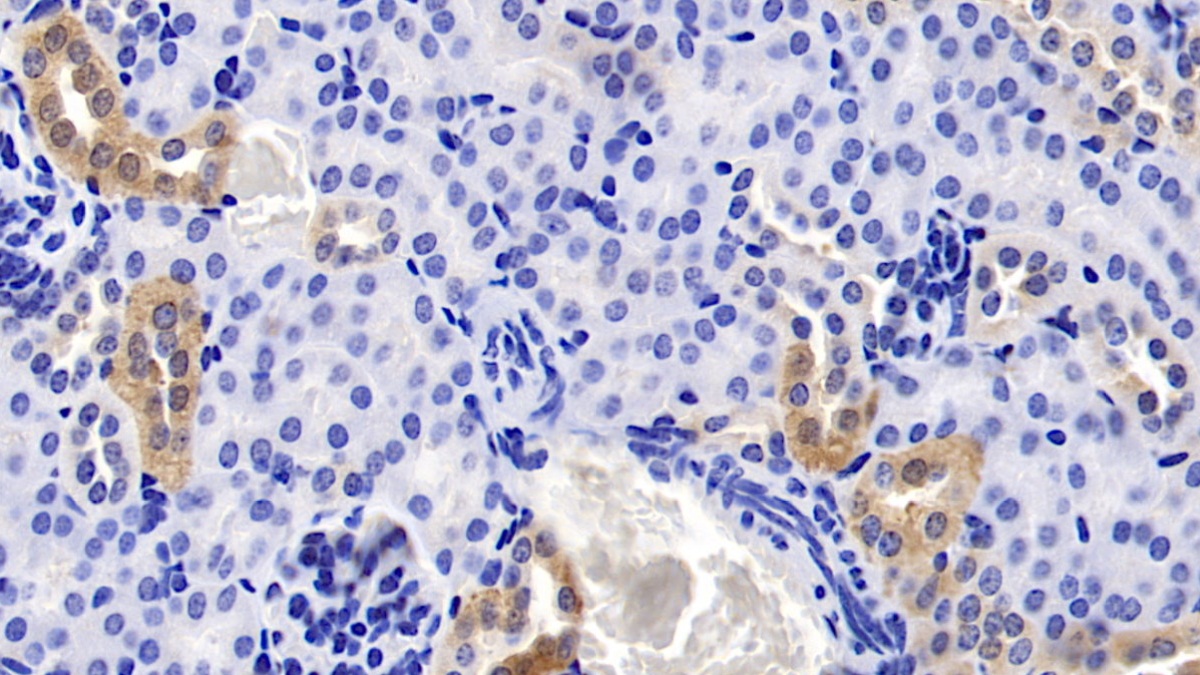 Monoclonal Antibody to Cyclophilin A (CYPA)