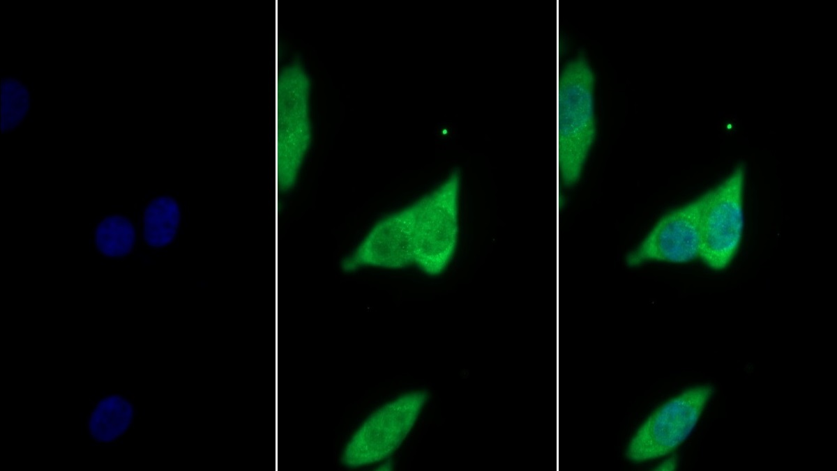 Monoclonal Antibody to Cyclophilin A (CYPA)