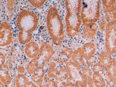 Monoclonal Antibody to Beta Catenin (β-catenin)