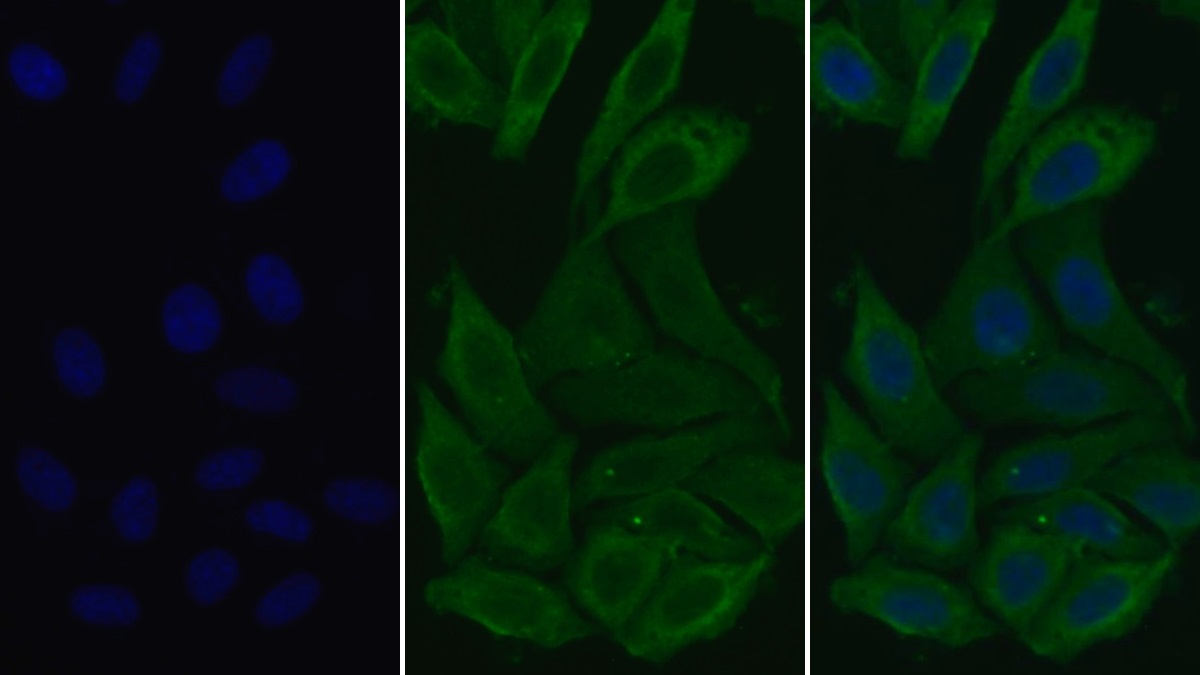 Monoclonal Antibody to Surfactant Associated Protein D (SPD)