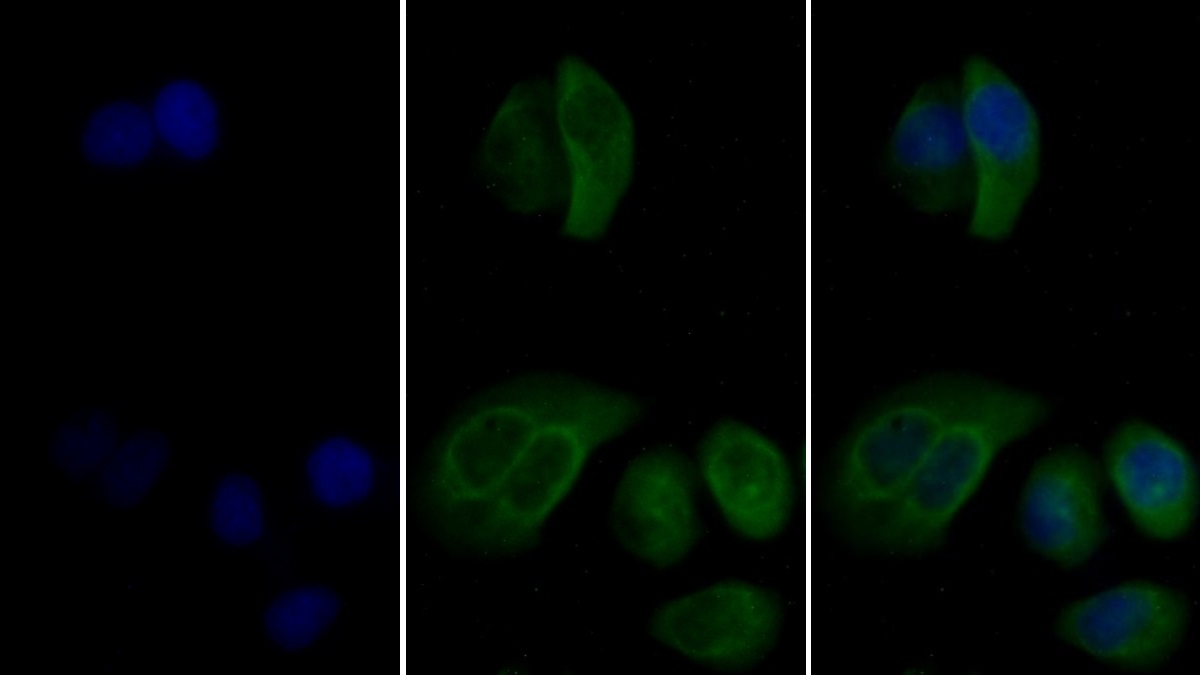 Monoclonal Antibody to Vimentin (VIM)