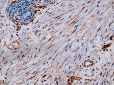 Monoclonal Antibody to Vimentin (VIM)