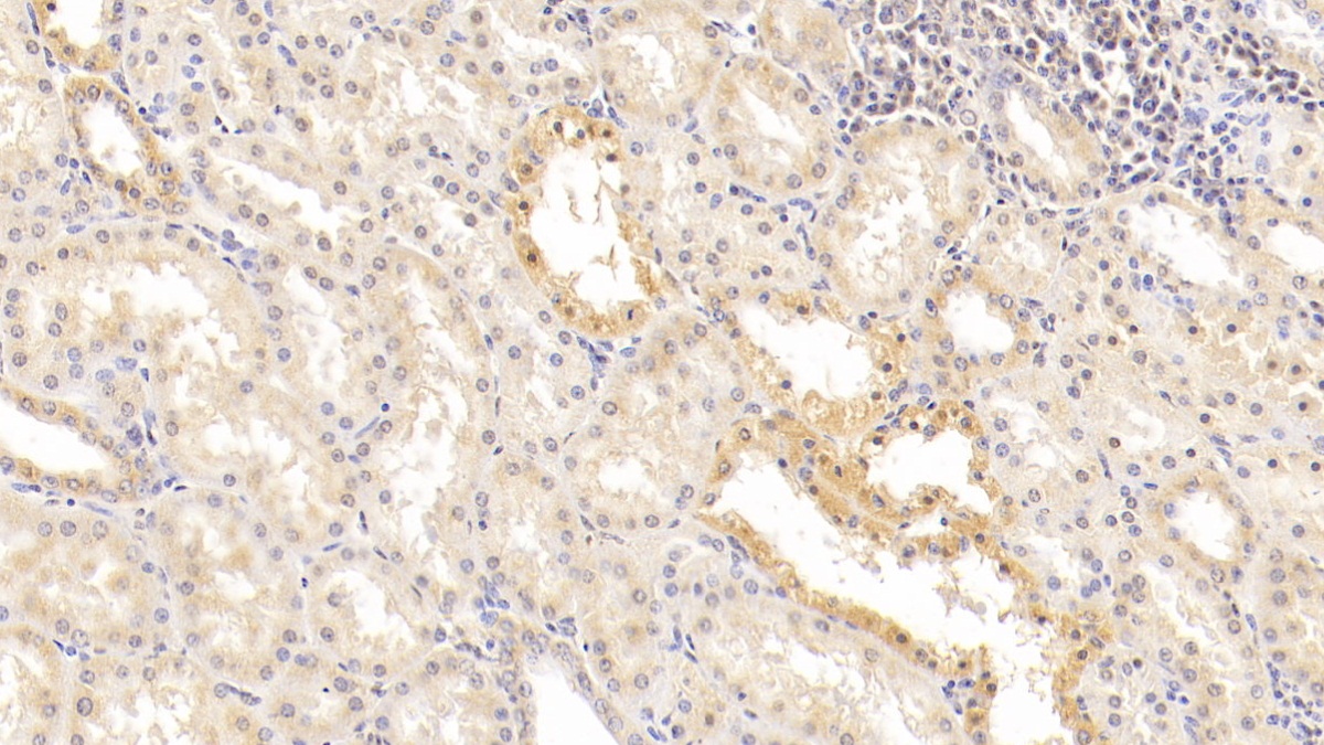 Monoclonal Antibody to Integrin Beta 1 (ITGb1)