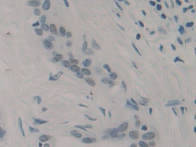 Monoclonal Antibody to Cholecystokinin 8 (CCK8)