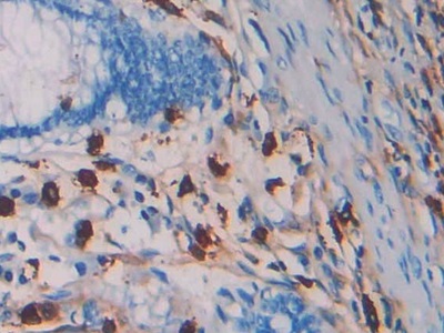 Monoclonal Antibody to Tryptase (TPS)