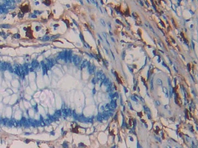 Monoclonal Antibody to Tryptase (TPS)