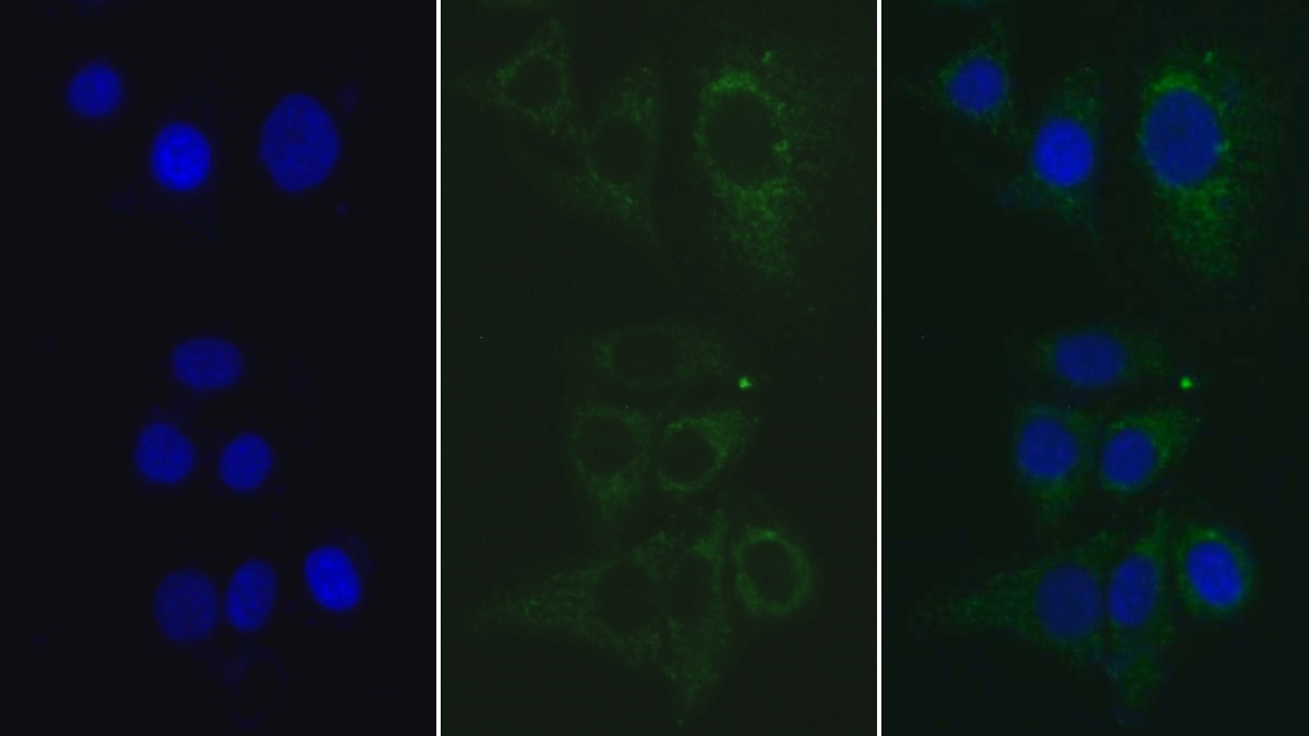 Monoclonal Antibody to S100 Calcium Binding Protein A12 (S100A12)