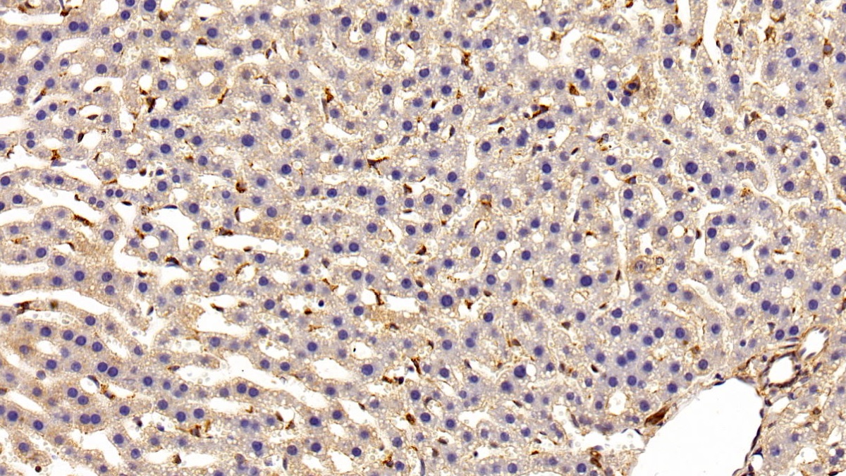 Monoclonal Antibody to Glutathione S Transferase Pi (GSTp)