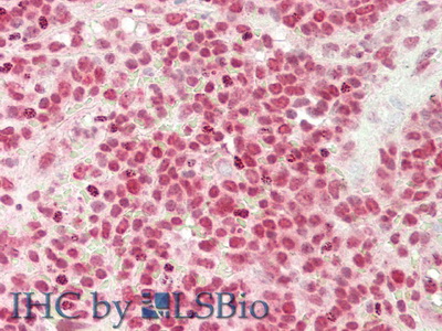 Monoclonal Antibody to Deoxyribonuclease I (DNASE1)