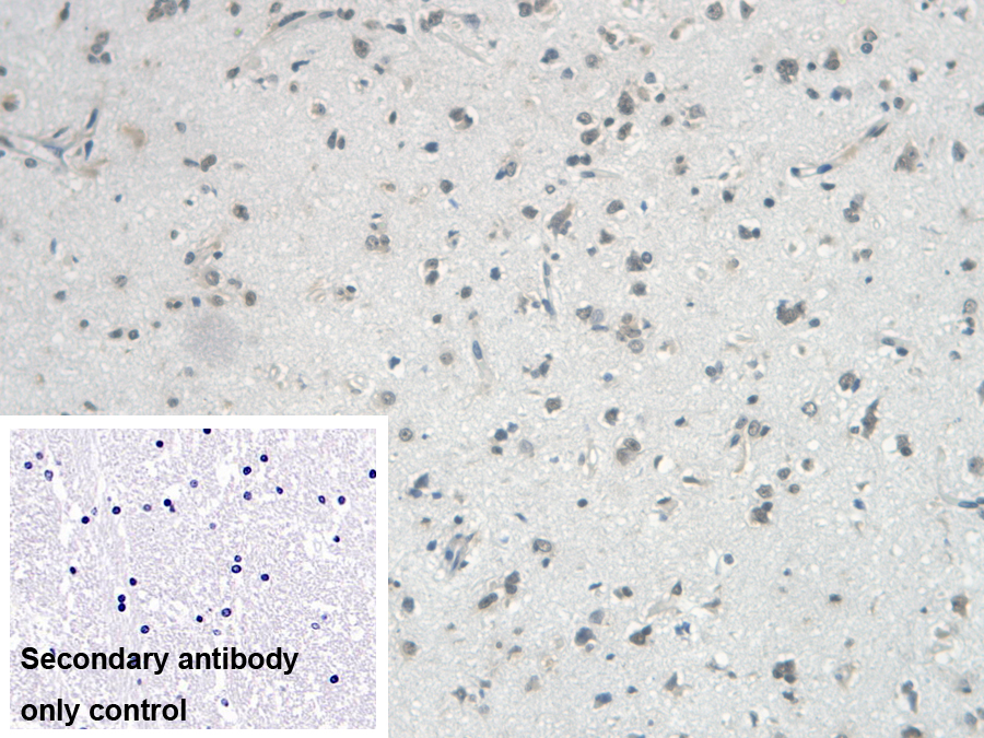 Monoclonal Antibody to VGF Nerve Growth Factor Inducible (VGF)